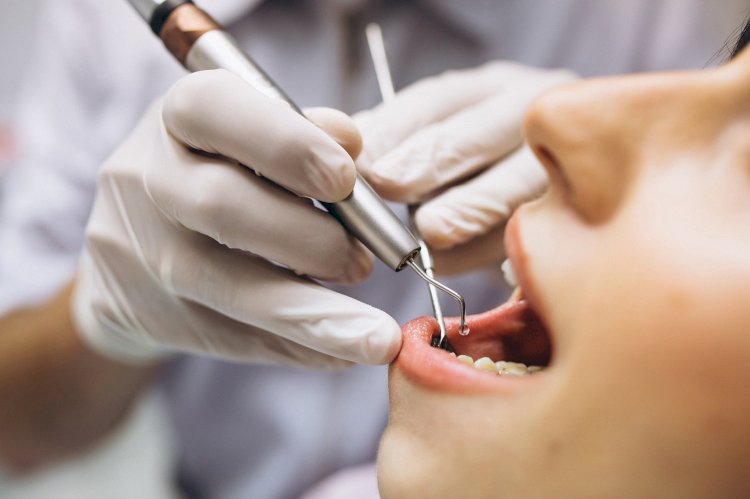 What Is the Recovery Time After Wisdom Teeth Removal?