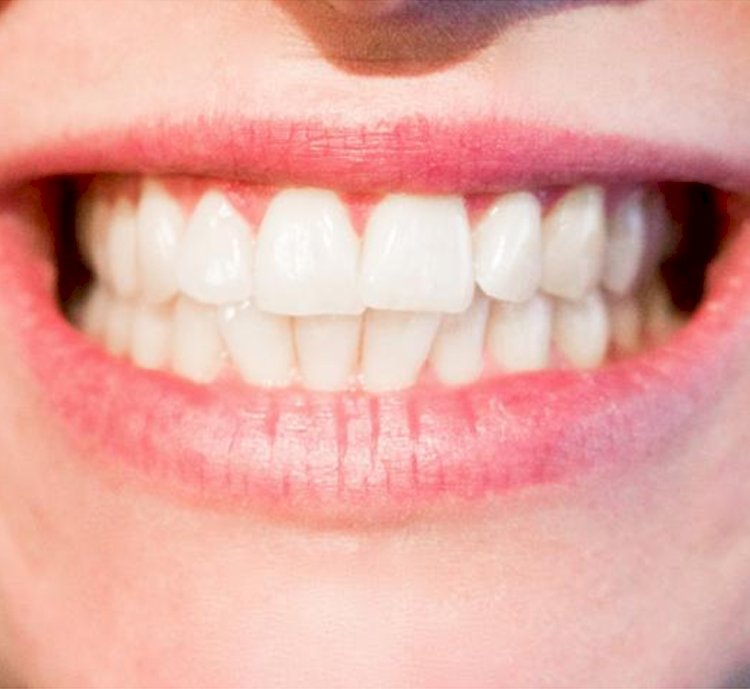 Things to Carry Out About Cosmetic Dentistry Services